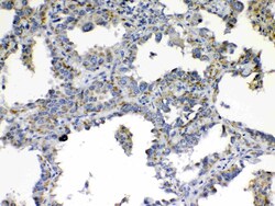 Invitrogen TIMP4 Polyclonal Antibody 100 &mu;g; Unconjugated:Antibodies,