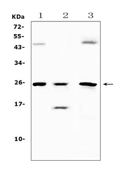 Invitrogen TIMP4 Polyclonal Antibody 100 &mu;g; Unconjugated:Antibodies,