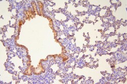 Invitrogen HSP20 Polyclonal Antibody 100 &mu;g; Unconjugated:Antibodies,
