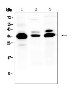 Invitrogen IL-1 beta Polyclonal Antibody 100 &mu;g; Unconjugated:Antibodies,