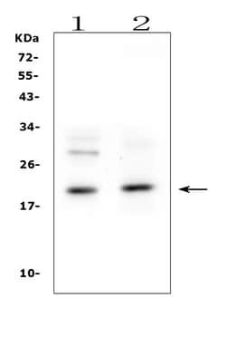 Invitrogen IL1RA Polyclonal Antibody 100 &mu;g | Buy Online | Invitrogen&trade; | Fisher Scientific