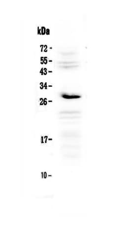 Invitrogen IL1RA Polyclonal Antibody 100 &mu;g; Unconjugated:Antibodies,