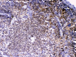 Invitrogen Lyn Polyclonal Antibody 100 &mu;g; Unconjugated:Antibodies,