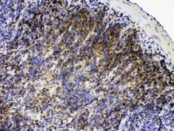 Invitrogen Lyn Polyclonal Antibody 100 &mu;g; Unconjugated:Antibodies,