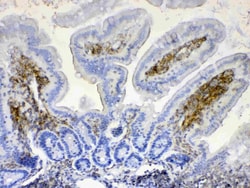 Invitrogen Lyn Polyclonal Antibody 100 &mu;g; Unconjugated:Antibodies,