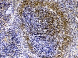 Invitrogen Lyn Polyclonal Antibody 100 &mu;g; Unconjugated:Antibodies,