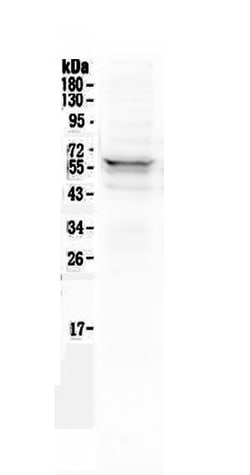 Invitrogen Lyn Polyclonal Antibody 100 &mu;g; Unconjugated:Antibodies,