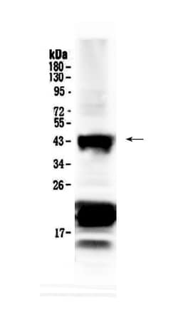 Invitrogen CHX10 Polyclonal Antibody 100 &mu;g; Unconjugated:Antibodies,