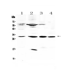 Invitrogen VEGFB Polyclonal Antibody 100 &mu;g; Unconjugated:Antibodies,
