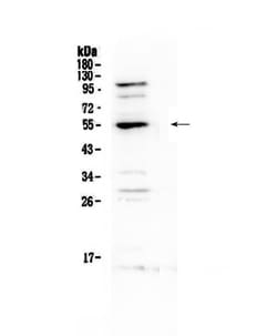 Invitrogen EpoR Polyclonal Antibody 100 &mu;g | Buy Online | Invitrogen&trade; | Fisher Scientific