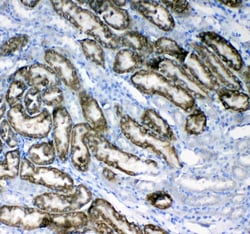Invitrogen Glycerol kinase Polyclonal Antibody 100 &mu;g; Unconjugated:Antibodies,