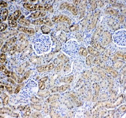 Invitrogen Glycerol kinase Polyclonal Antibody 100 &mu;g; Unconjugated:Antibodies,