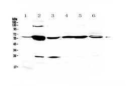 Invitrogen Glycerol kinase Polyclonal Antibody 100 &mu;g; Unconjugated:Antibodies,