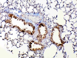 Invitrogen MMP13 Polyclonal Antibody 100 &mu;g; Unconjugated:Antibodies,