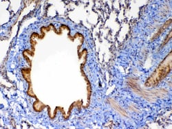 Invitrogen MMP13 Polyclonal Antibody 100 &mu;g; Unconjugated:Antibodies,