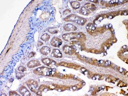 Invitrogen MMP13 Polyclonal Antibody 100 &mu;g; Unconjugated:Antibodies,