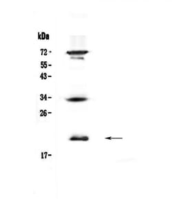 Invitrogen IL17B Polyclonal Antibody 100 &mu;g; Unconjugated:Antibodies,