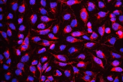 Invitrogen DYRK1A Polyclonal Antibody 100 &mu;g; Unconjugated:Antibodies,