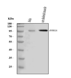 Invitrogen DYRK1A Polyclonal Antibody 100 &mu;g; Unconjugated:Antibodies,