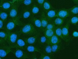 Invitrogen S100A10 Polyclonal Antibody 100 &mu;g; Unconjugated:Antibodies,