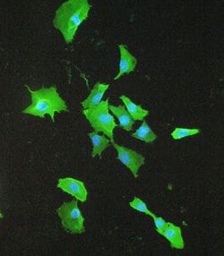 Invitrogen S100A10 Polyclonal Antibody 100 &mu;g; Unconjugated:Antibodies,