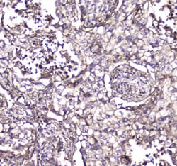 Invitrogen S100A10 Polyclonal Antibody 100 &mu;g; Unconjugated:Antibodies,