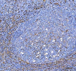 Invitrogen S100A10 Polyclonal Antibody 100 &mu;g; Unconjugated:Antibodies,