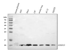 Invitrogen S100A10 Polyclonal Antibody 100 &mu;g | Buy Online | Invitrogen&trade; | Fisher Scientific