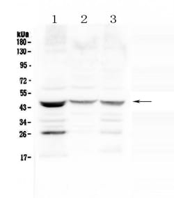 Invitrogen SFTPB Polyclonal Antibody 100 &mu;g | Buy Online | Invitrogen&trade; | Fisher Scientific