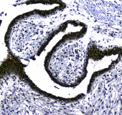 Invitrogen STUB1 Polyclonal Antibody 100 &mu;g; Unconjugated:Antibodies,