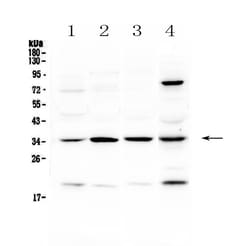 Invitrogen STUB1 Polyclonal Antibody 100 &mu;g; Unconjugated:Antibodies,