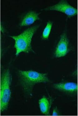 Invitrogen ESRRG Polyclonal Antibody 100 &mu;g; Unconjugated:Antibodies,