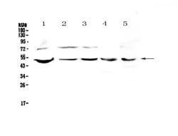 Invitrogen ESRRG Polyclonal Antibody 100 &mu;g; Unconjugated:Antibodies,
