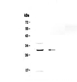 Invitrogen GPR40 Polyclonal Antibody 100 &mu;g; Unconjugated:Antibodies,