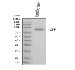 Invitrogen&trade;&nbsp;Lactoferrin Polyclonal Antibody