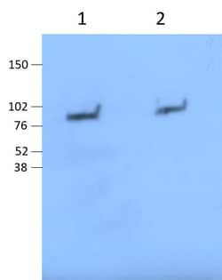 Invitrogen Lactoferrin Polyclonal Antibody 100 &mu;g | Buy Online | Invitrogen&trade; | Fisher Scientific