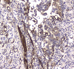 Invitrogen LC3A Polyclonal Antibody 100 &mu;g; Unconjugated:Antibodies,