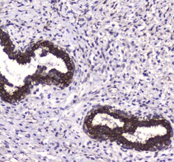 Invitrogen LC3A Polyclonal Antibody 100 &mu;g; Unconjugated:Antibodies,