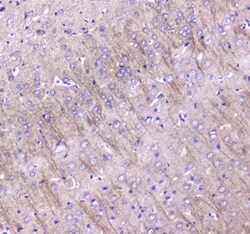 Invitrogen LC3A Polyclonal Antibody 100 &mu;g; Unconjugated:Antibodies,