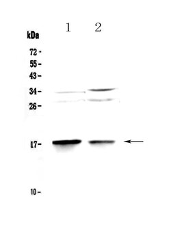 Invitrogen LC3A Polyclonal Antibody 100 &mu;g; Unconjugated:Antibodies,