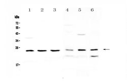 Invitrogen RAB6A Polyclonal Antibody 100 &mu;g; Unconjugated:Antibodies,