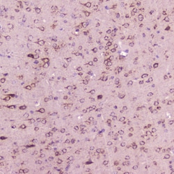 Invitrogen Calcitonin Polyclonal Antibody 100 &mu;g | Buy Online | Invitrogen&trade; | Fisher Scientific