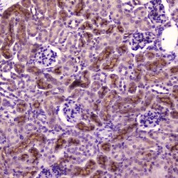 Invitrogen PDGFRB Polyclonal Antibody 100 &mu;g; Unconjugated:Antibodies,