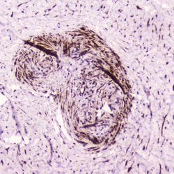 Invitrogen PDGFRB Polyclonal Antibody 100 &mu;g; Unconjugated:Antibodies,