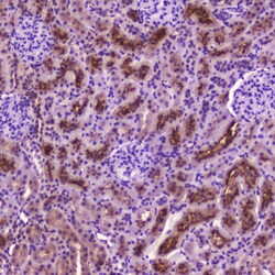 Invitrogen PDGFRB Polyclonal Antibody 100 &mu;g; Unconjugated:Antibodies,