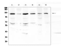 Invitrogen PDGFRB Polyclonal Antibody 100 &mu;g; Unconjugated:Antibodies,
