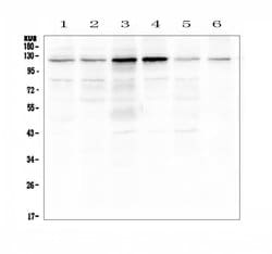 Invitrogen Smoothelin Polyclonal Antibody 100 &mu;g; Unconjugated:Antibodies,