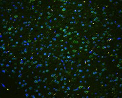Invitrogen TPR Polyclonal Antibody 100 &mu;g; Unconjugated:Antibodies,