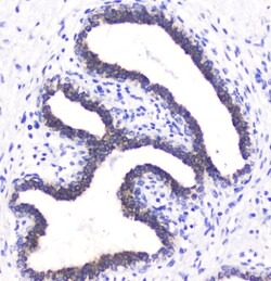 Invitrogen betacellulin Polyclonal Antibody 100 &mu;g | Buy Online | Invitrogen&trade; | Fisher Scientific