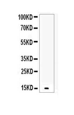 Invitrogen betacellulin Polyclonal Antibody 100 &mu;g | Buy Online | Invitrogen&trade; | Fisher Scientific